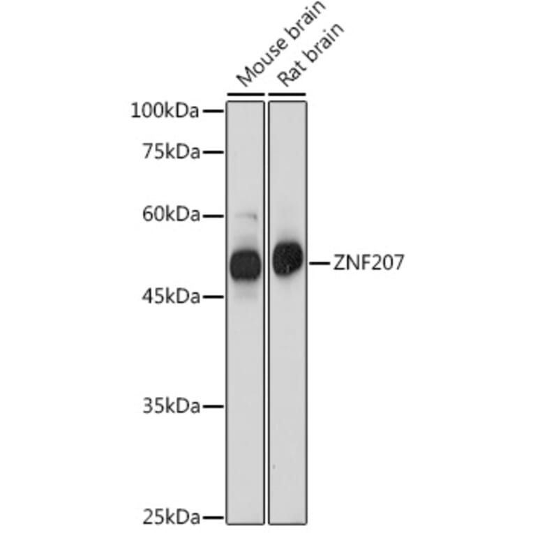 Western Blot - Anti-ZNF207/BUGZ Antibody (A307387) - Antibodies.com