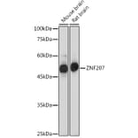 Western Blot - Anti-ZNF207/BUGZ Antibody (A307387) - Antibodies.com