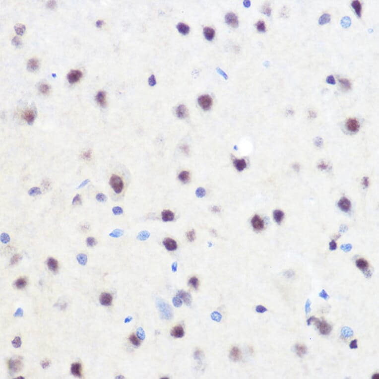 Immunohistochemistry - Anti-ZNF207/BUGZ Antibody (A307387) - Antibodies.com