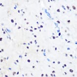 Immunohistochemistry - Anti-ZNF207/BUGZ Antibody (A307387) - Antibodies.com