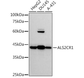 Western Blot - Anti-ALS2CR1 Antibody [ARC2775] (A307388) - Antibodies.com