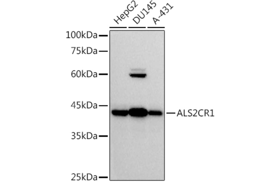 Western Blot - Anti-ALS2CR1 Antibody [ARC2775] (A307388) - Antibodies.com