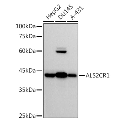 Western Blot - Anti-ALS2CR1 Antibody [ARC2775] (A307388) - Antibodies.com