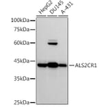 Western Blot - Anti-ALS2CR1 Antibody [ARC2775] (A307388) - Antibodies.com