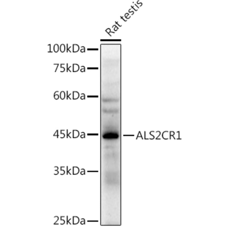 Western Blot - Anti-ALS2CR1 Antibody [ARC2775] (A307388) - Antibodies.com