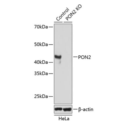 Western Blot - Anti-PON2 Antibody (A307389) - Antibodies.com