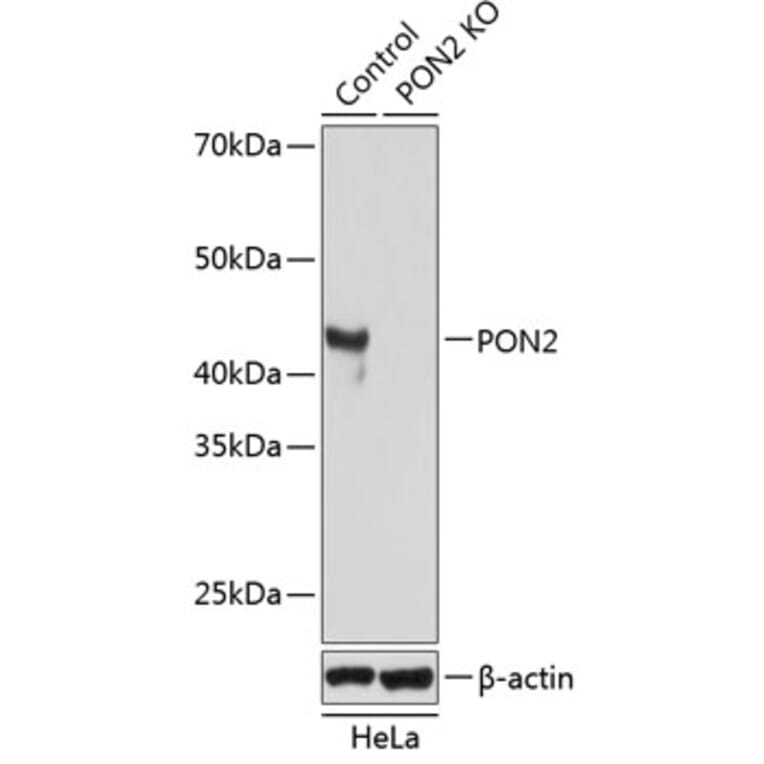 Western Blot - Anti-PON2 Antibody (A307389) - Antibodies.com