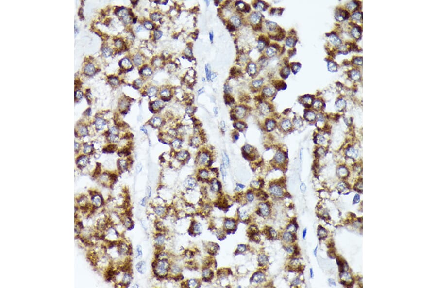 Immunohistochemistry - Anti-CDCA3 Antibody [ARC2135] (A307391) - Antibodies.com