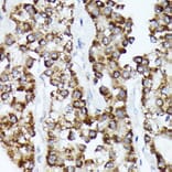 Immunohistochemistry - Anti-CDCA3 Antibody [ARC2135] (A307391) - Antibodies.com