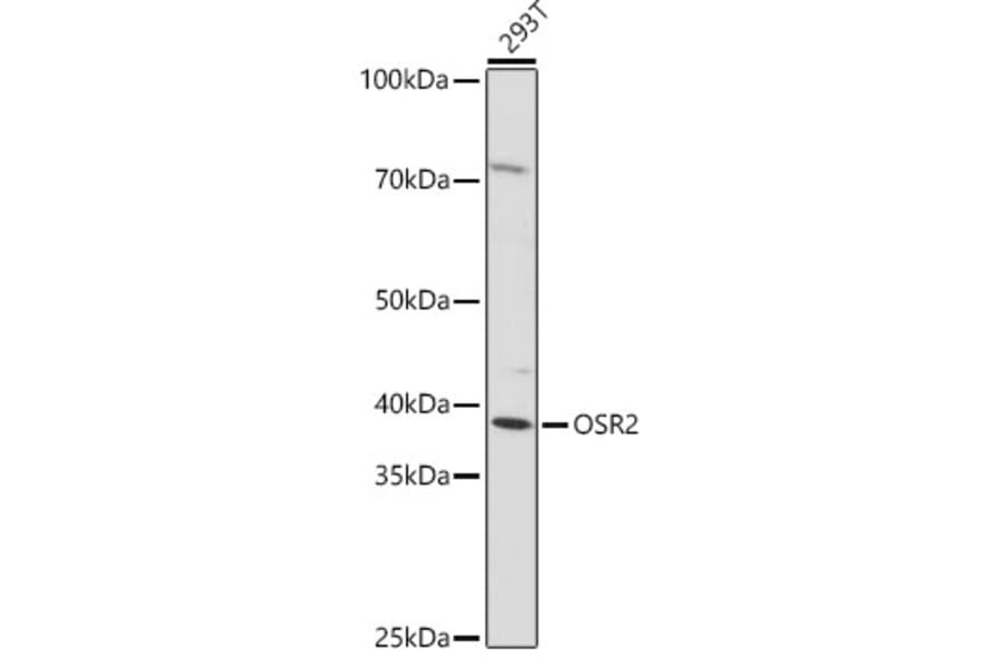 Western Blot - Anti-OSR2 Antibody (A307393) - Antibodies.com