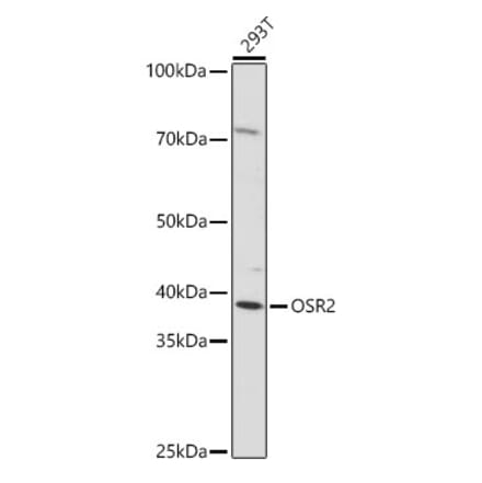 Western Blot - Anti-OSR2 Antibody (A307393) - Antibodies.com