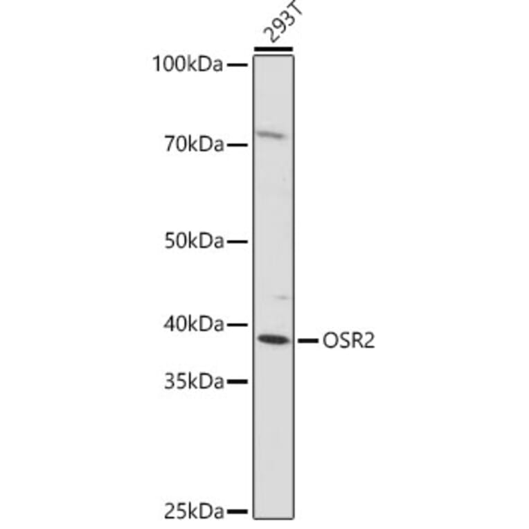 Western Blot - Anti-OSR2 Antibody (A307393) - Antibodies.com
