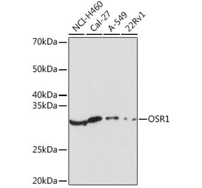 Western Blot - Anti-OSR1 Antibody (A307394) - Antibodies.com