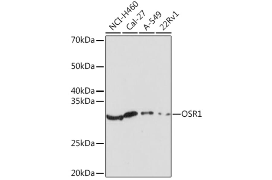 Western Blot - Anti-OSR1 Antibody (A307394) - Antibodies.com