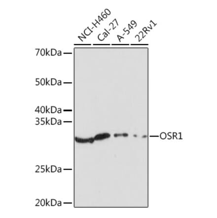 Western Blot - Anti-OSR1 Antibody (A307394) - Antibodies.com