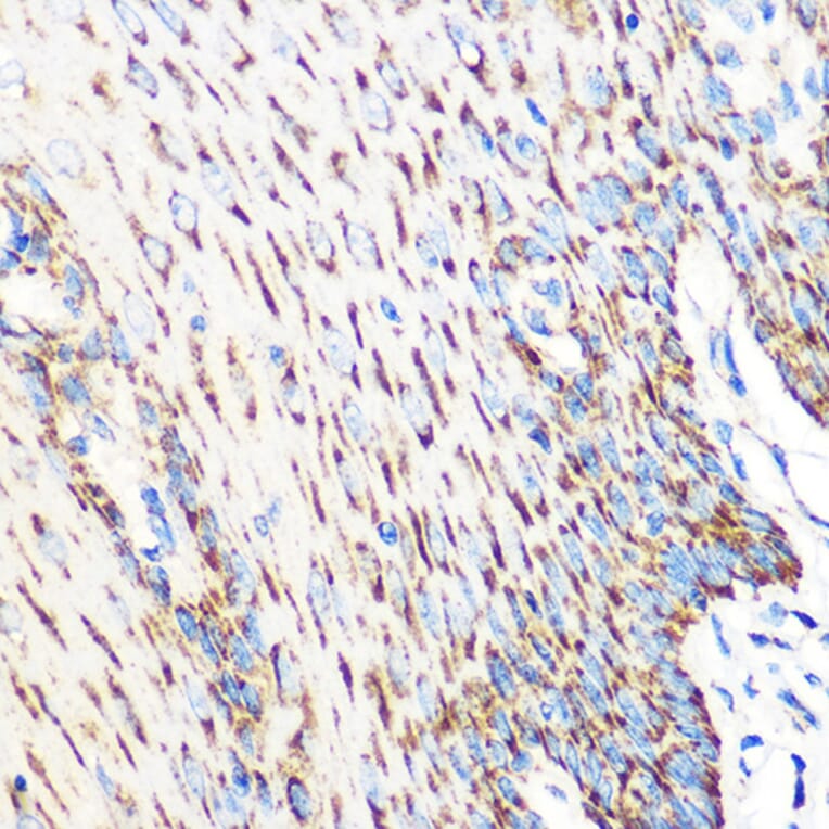 Immunohistochemistry - Anti-OSR1 Antibody (A307394) - Antibodies.com