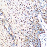 Immunohistochemistry - Anti-OSR1 Antibody (A307394) - Antibodies.com