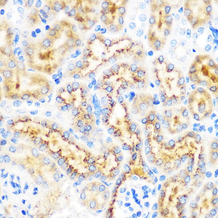 Immunohistochemistry - Anti-OSR1 Antibody (A307394) - Antibodies.com