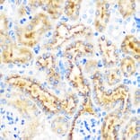 Immunohistochemistry - Anti-OSR1 Antibody (A307394) - Antibodies.com