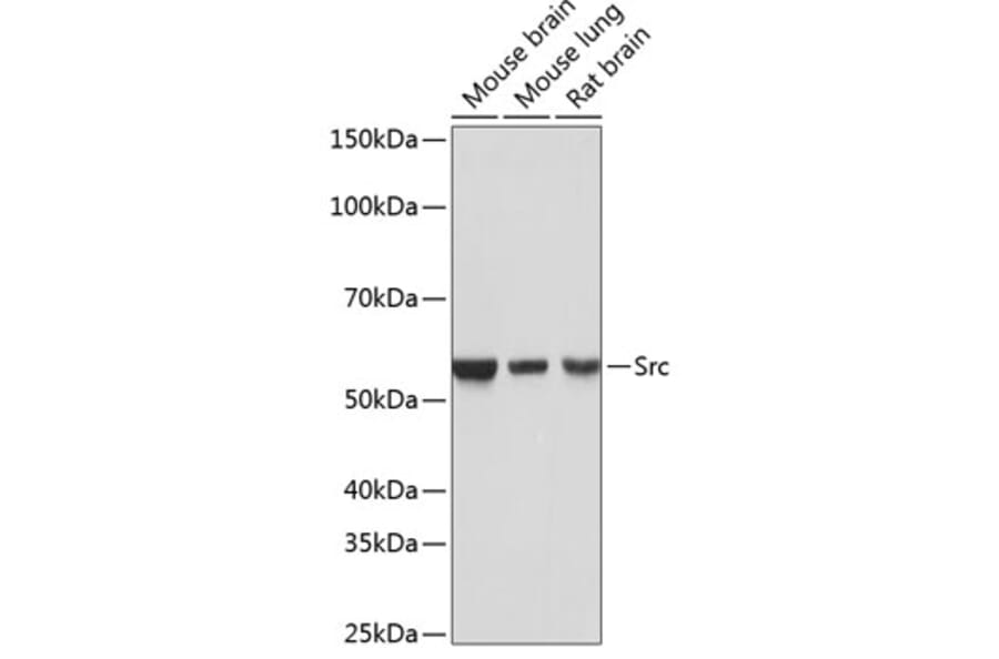 Western Blot - Anti-Src Antibody [ARC0378] (A307395) - Antibodies.com