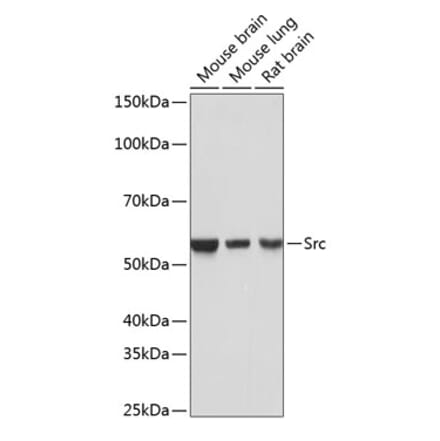 Western Blot - Anti-Src Antibody [ARC0378] (A307395) - Antibodies.com