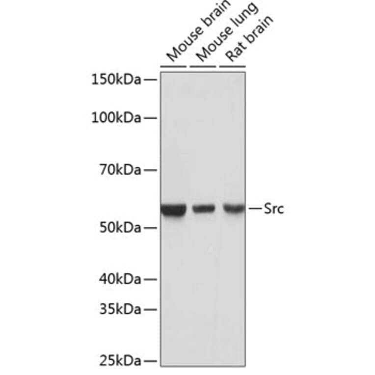 Western Blot - Anti-Src Antibody [ARC0378] (A307395) - Antibodies.com