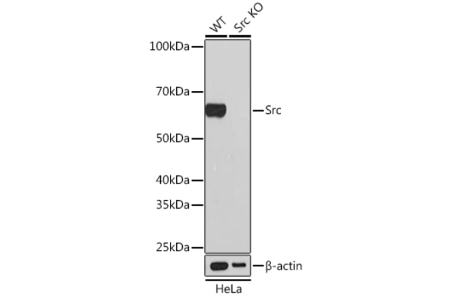 Western Blot - Anti-Src Antibody [ARC0378] (A307395) - Antibodies.com