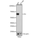 Western Blot - Anti-Src Antibody [ARC0378] (A307395) - Antibodies.com