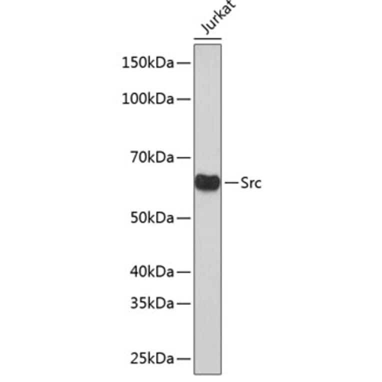 Western Blot - Anti-Src Antibody [ARC0378] (A307395) - Antibodies.com