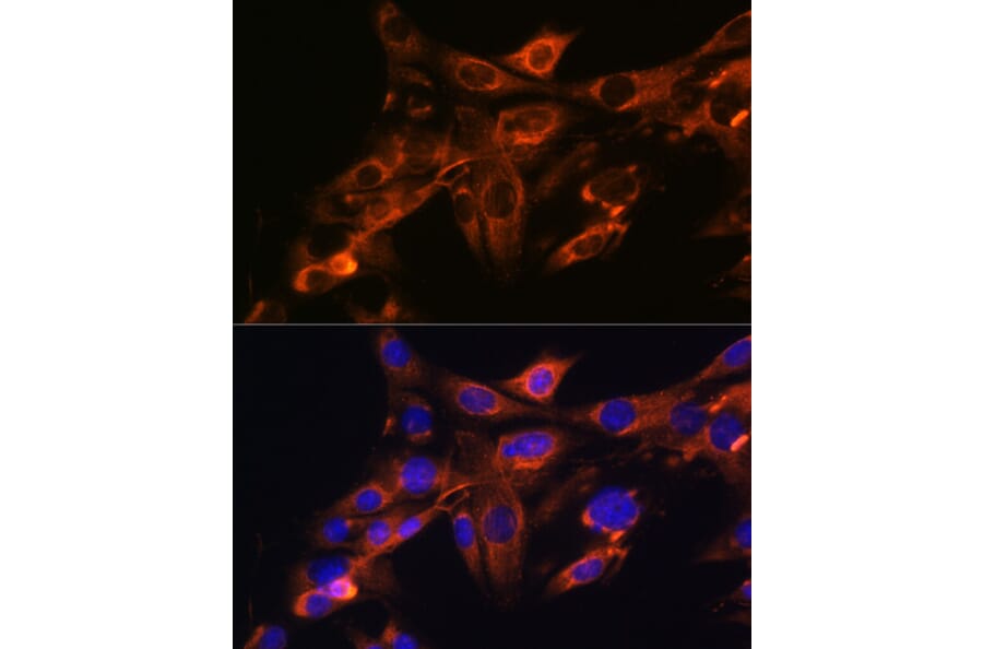 Immunofluorescence - Anti-Src Antibody [ARC0378] (A307395) - Antibodies.com
