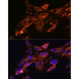 Immunofluorescence - Anti-Src Antibody [ARC0378] (A307395) - Antibodies.com