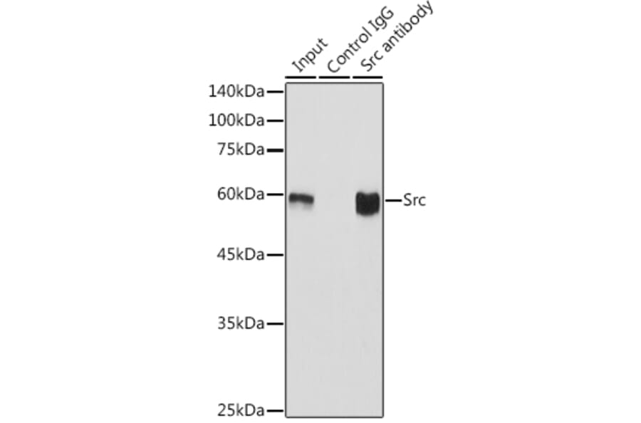 Western Blot - Anti-Src Antibody [ARC0378] (A307395) - Antibodies.com
