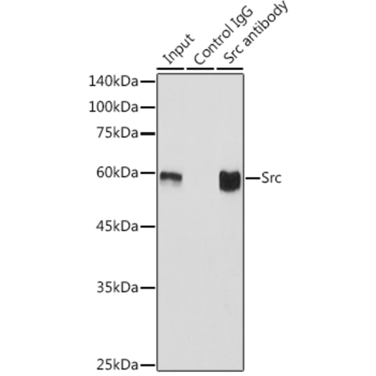 Western Blot - Anti-Src Antibody [ARC0378] (A307395) - Antibodies.com