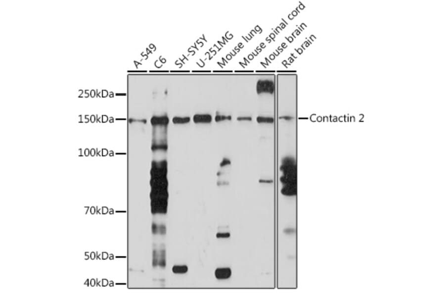 Western Blot - Anti-TAG1/TAX1 Antibody [ARC1984] (A307397) - Antibodies.com