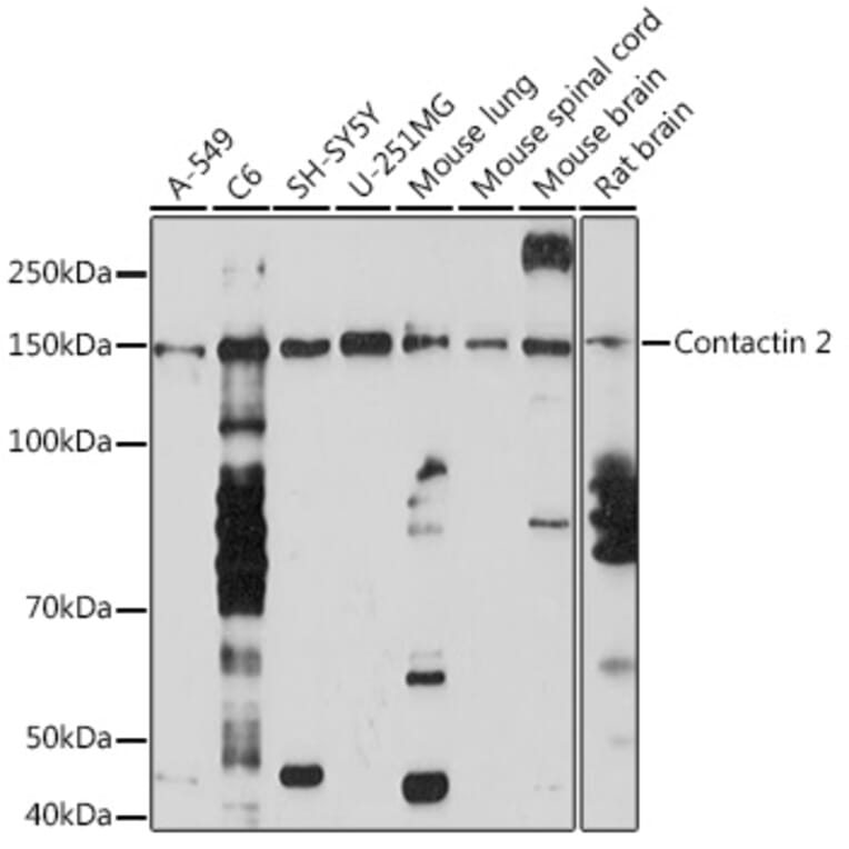 Western Blot - Anti-TAG1/TAX1 Antibody [ARC1984] (A307397) - Antibodies.com