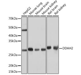 Western Blot - Anti-DDAH2 Antibody [ARC0910] (A307398) - Antibodies.com