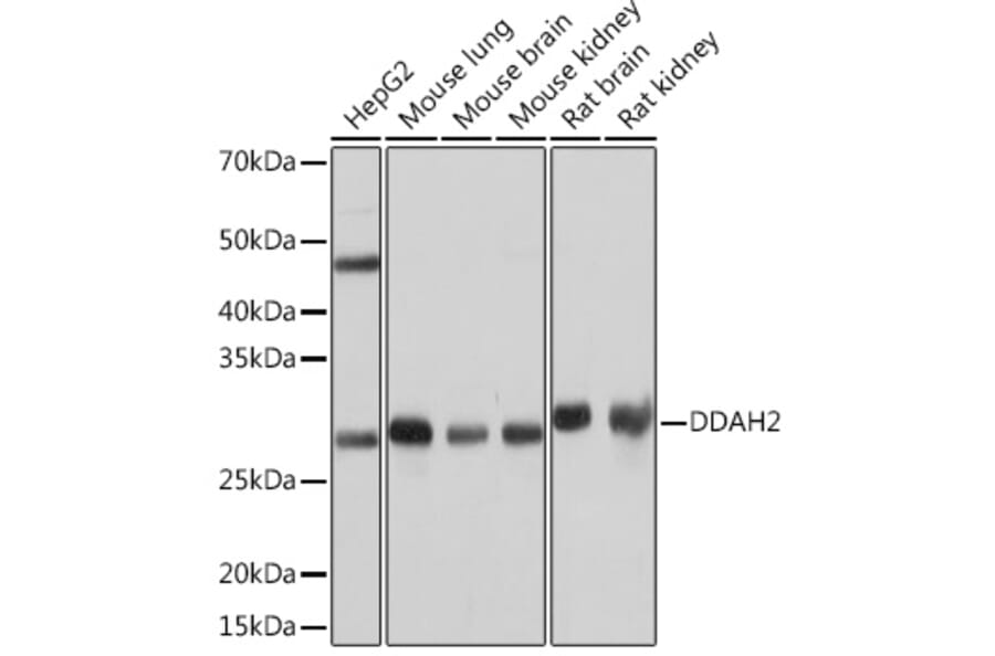 Western Blot - Anti-DDAH2 Antibody [ARC0910] (A307398) - Antibodies.com