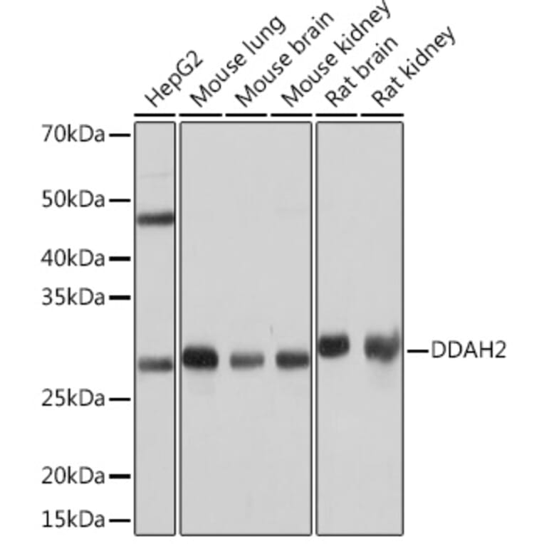 Western Blot - Anti-DDAH2 Antibody [ARC0910] (A307398) - Antibodies.com