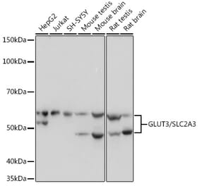 Western Blot - Anti-Glucose Transporter GLUT3 Antibody [ARC0917] (A307399) - Antibodies.com