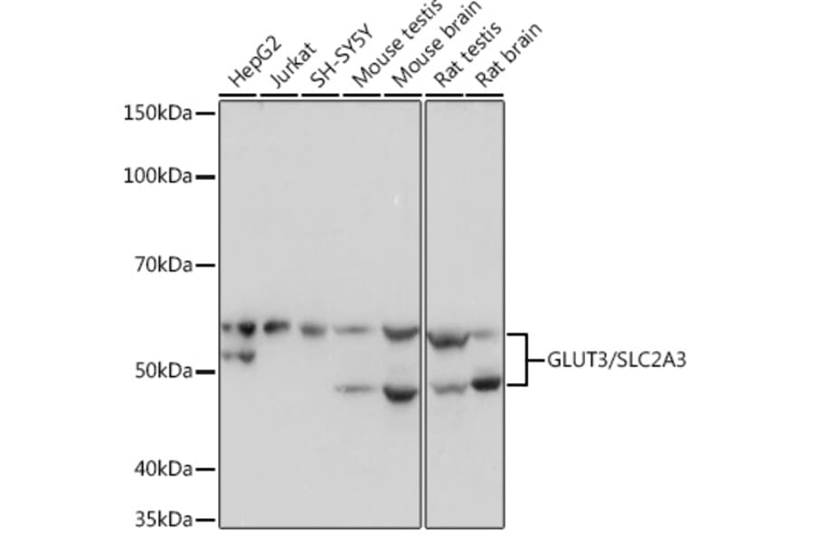 Western Blot - Anti-Glucose Transporter GLUT3 Antibody [ARC0917] (A307399) - Antibodies.com