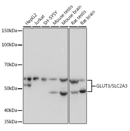 Western Blot - Anti-Glucose Transporter GLUT3 Antibody [ARC0917] (A307399) - Antibodies.com