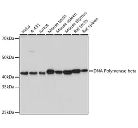 Western Blot - Anti-DNA Polymerase beta Antibody [ARC0752] (A307402) - Antibodies.com