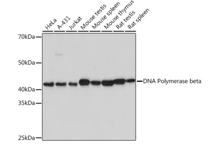 Western Blot - Anti-DNA Polymerase beta Antibody [ARC0752] (A307402) - Antibodies.com