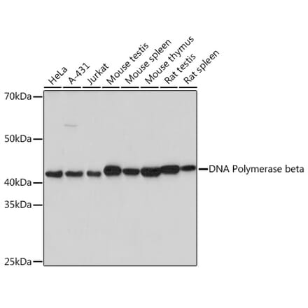 Western Blot - Anti-DNA Polymerase beta Antibody [ARC0752] (A307402) - Antibodies.com