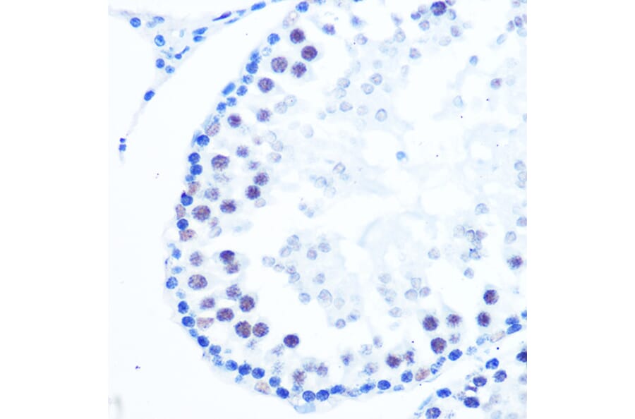 Immunohistochemistry - Anti-DNA Polymerase beta Antibody [ARC0752] (A307402) - Antibodies.com
