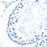Immunohistochemistry - Anti-DNA Polymerase beta Antibody [ARC0752] (A307402) - Antibodies.com