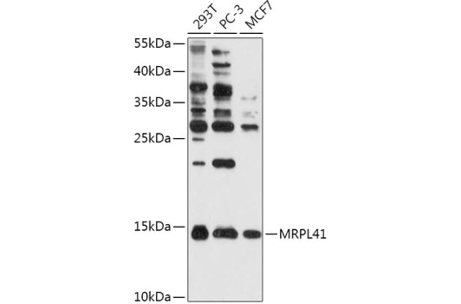 Western Blot - Anti-MRPL41 Antibody (A307403) - Antibodies.com