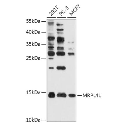 Western Blot - Anti-MRPL41 Antibody (A307403) - Antibodies.com