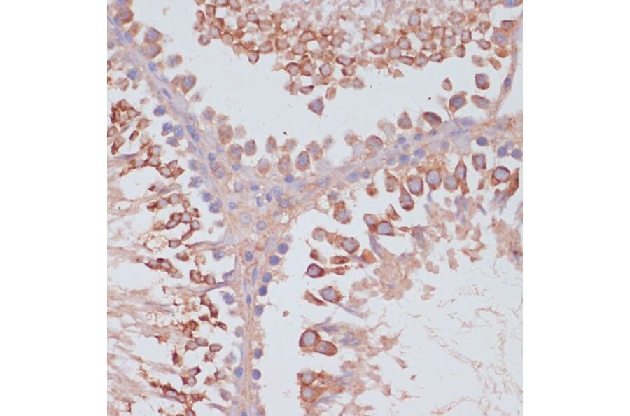Immunohistochemistry - Anti-MRPL41 Antibody (A307403) - Antibodies.com