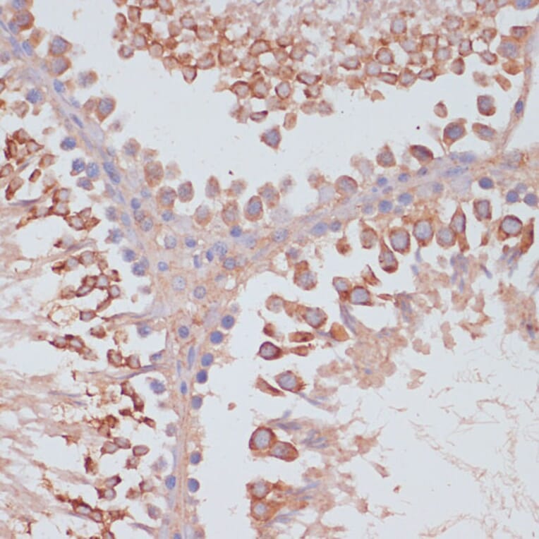 Immunohistochemistry - Anti-MRPL41 Antibody (A307403) - Antibodies.com